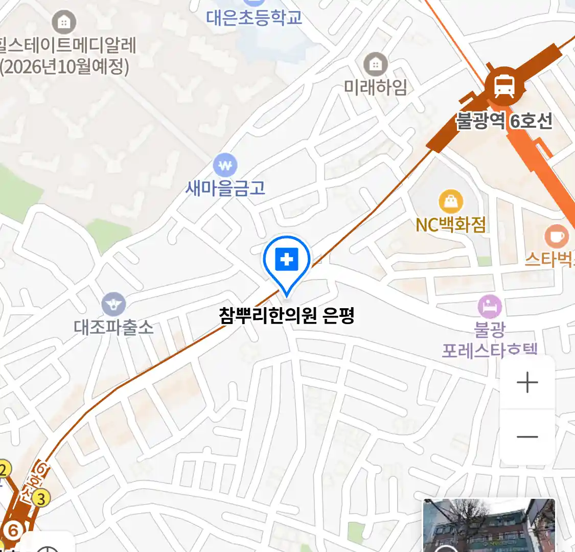 참뿌리한의원 은평 위치